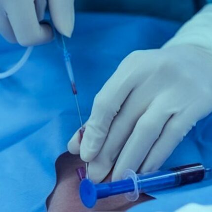 CATÉTER INTRAVENOSOS DESECHABLES