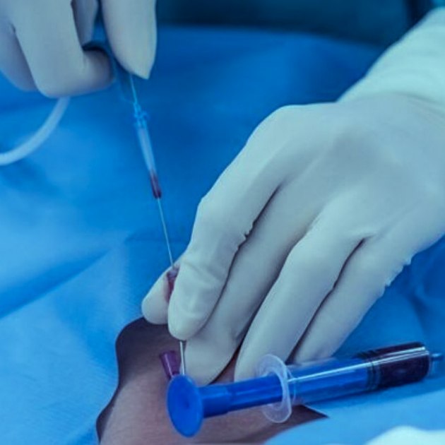 10 CATÉTER INTRAVENOSOS DESECHABLES - Imagen 1